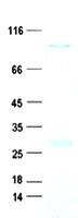 SYBU Protein