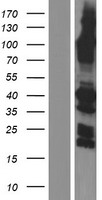 SYCE1 Protein - Western validation with an anti-DDK antibody * L: Control HEK293 lysate R: Over-expression lysate