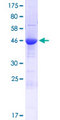 SYCE1 Protein - 12.5% SDS-PAGE of human SYCE1 stained with Coomassie Blue
