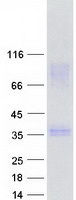 SYCE1 Protein - Purified recombinant protein SYCE1 was analyzed by SDS-PAGE gel and Coomassie Blue Staining