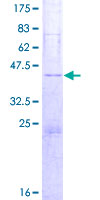 SYCN Protein - 12.5% SDS-PAGE of human SYCN stained with Coomassie Blue