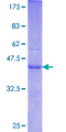 SYCN Protein - 12.5% SDS-PAGE of human SYCN stained with Coomassie Blue