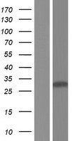 SYCP3 / SCP3 Protein - Western validation with an anti-DDK antibody * L: Control HEK293 lysate R: Over-expression lysate