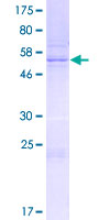 SYCP3 / SCP3 Protein - 12.5% SDS-PAGE of human SYCP3 stained with Coomassie Blue