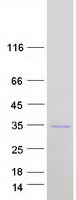 SYCP3 / SCP3 Protein - Purified recombinant protein SYCP3 was analyzed by SDS-PAGE gel and Coomassie Blue Staining