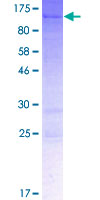 SYDE1 Protein - 12.5% SDS-PAGE of human SYDE1 stained with Coomassie Blue