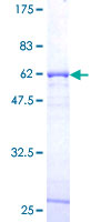 SYF2 / p29 Protein - 12.5% SDS-PAGE of human SYF2 stained with Coomassie Blue