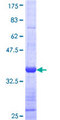 SYK Protein - 12.5% SDS-PAGE Stained with Coomassie Blue.