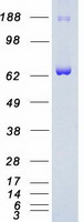 SYK Protein - Purified recombinant protein SYK was analyzed by SDS-PAGE gel and Coomassie Blue Staining