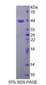 SYMPK / Symplekin Protein - Recombinant Symplekin By SDS-PAGE