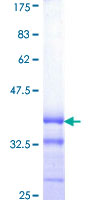 SYN / FYN Protein - 12.5% SDS-PAGE Stained with Coomassie Blue.
