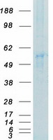 SYN / FYN Protein - Purified recombinant protein FYN was analyzed by SDS-PAGE gel and Coomassie Blue Staining