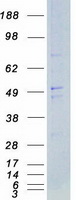 SYN / FYN Protein - Purified recombinant protein FYN was analyzed by SDS-PAGE gel and Coomassie Blue Staining