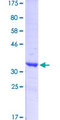 SYN1 / Synapsin 1 Protein - 12.5% SDS-PAGE Stained with Coomassie Blue.