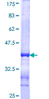SYN2 / Synapsin II Protein - 12.5% SDS-PAGE Stained with Coomassie Blue.