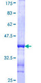 SYN2 / Synapsin II Protein - 12.5% SDS-PAGE Stained with Coomassie Blue.