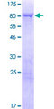 SYN3 / Synapsin III Protein - 12.5% SDS-PAGE of human SYN3 stained with Coomassie Blue