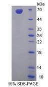 SYNC / SYNCOILIN Protein - Recombinant  Syncoilin By SDS-PAGE