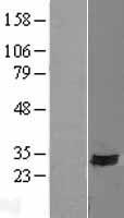 SYNDIG1 Protein - Western validation with an anti-DDK antibody * L: Control HEK293 lysate R: Over-expression lysate
