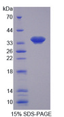 SYNE1 / Nesprin 1 Protein - Recombinant Nesprin 1 By SDS-PAGE