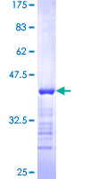 SYNE2 / Nesprin-2 Protein - 12.5% SDS-PAGE Stained with Coomassie Blue.