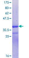 SYNGAP Protein - 12.5% SDS-PAGE Stained with Coomassie Blue.