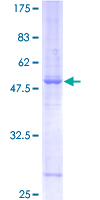SYNGR2 / Synaptogyrin 2 Protein - 12.5% SDS-PAGE of human SYNGR2 stained with Coomassie Blue