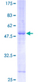 SYNGR2 / Synaptogyrin 2 Protein - 12.5% SDS-PAGE of human SYNGR2 stained with Coomassie Blue
