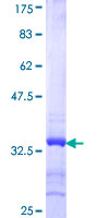 SYNGR2 / Synaptogyrin 2 Protein - 12.5% SDS-PAGE Stained with Coomassie Blue.