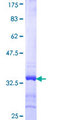 SYNGR2 / Synaptogyrin 2 Protein - 12.5% SDS-PAGE Stained with Coomassie Blue.