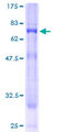 SYNGR3 / Synaptogyrin 3 Protein - 12.5% SDS-PAGE of human SYNGR3 stained with Coomassie Blue