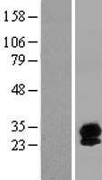 SYNGR4 / Synaptogyrin 4 Protein - Western validation with an anti-DDK antibody * L: Control HEK293 lysate R: Over-expression lysate