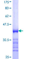 SYNJ1 / Synaptojanin Protein - 12.5% SDS-PAGE Stained with Coomassie Blue.