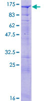 SYNJ2 / Synaptojanin 2 Protein - 12.5% SDS-PAGE of human SYNJ2 stained with Coomassie Blue
