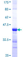 SYNJ2 / Synaptojanin 2 Protein - 12.5% SDS-PAGE Stained with Coomassie Blue.