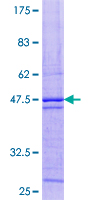 SYNJ2BP / OMP25 Protein - 12.5% SDS-PAGE of human SYNJ2BP stained with Coomassie Blue