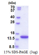 SYNJ2BP / OMP25 Protein