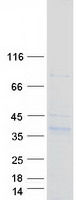 SYNPR / Synaptoporin Protein - Purified recombinant protein SYNPR was analyzed by SDS-PAGE gel and Coomassie Blue Staining