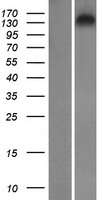 SYNRG Protein - Western validation with an anti-DDK antibody * L: Control HEK293 lysate R: Over-expression lysate