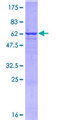 SYP / Synaptophysin Protein - 12.5% SDS-PAGE of human SYP stained with Coomassie Blue