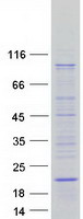SYS1 Protein - Purified recombinant protein SYS1 was analyzed by SDS-PAGE gel and Coomassie Blue Staining