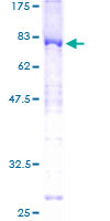 SYT1 / Synaptotagmin Protein - 12.5% SDS-PAGE of human SYT1 stained with Coomassie Blue
