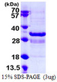 SYT1 / Synaptotagmin Protein