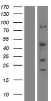 SYT12 / Synaptotagmin12 Protein - Western validation with an anti-DDK antibody * L: Control HEK293 lysate R: Over-expression lysate