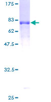 SYT12 / Synaptotagmin12 Protein - 12.5% SDS-PAGE of human SYT12 stained with Coomassie Blue