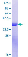 SYT13 Protein - 12.5% SDS-PAGE Stained with Coomassie Blue.