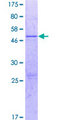 SYT16 Protein - 12.5% SDS-PAGE of human SYT16 stained with Coomassie Blue
