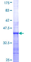 SYT2 Protein - 12.5% SDS-PAGE Stained with Coomassie Blue.