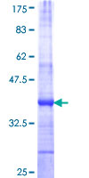 SYT4 Protein - 12.5% SDS-PAGE Stained with Coomassie Blue.