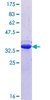 SYT7 / Synaptotagmin 7 Protein - 12.5% SDS-PAGE Stained with Coomassie Blue.